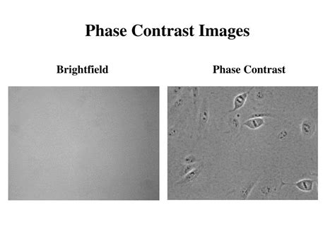 Ppt Contrast Microscopy Powerpoint Presentation Free Download Id