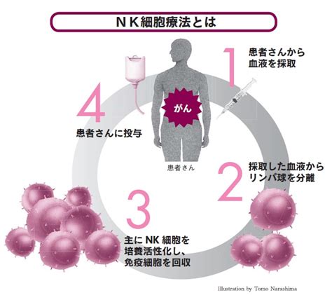 がん免疫療法で新たに注目される「nk（ナチュラルキラー）細胞」 がんと免疫 「がん治療」新時代