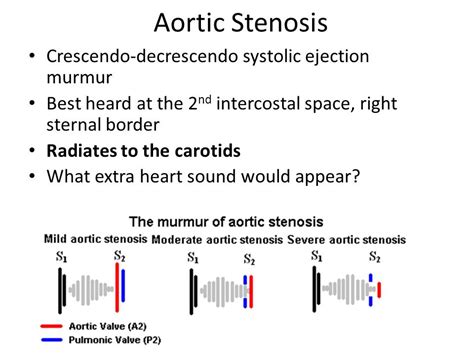 Coronary heart Murmur proper Sternal Border