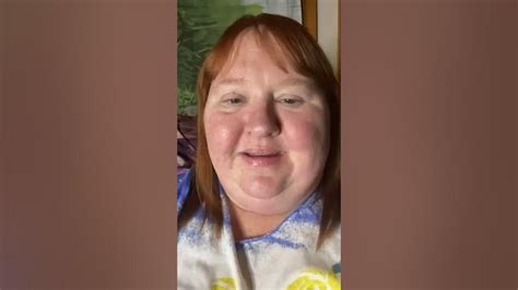 Why Its Important To Advocate For Down Syndrome Youtube