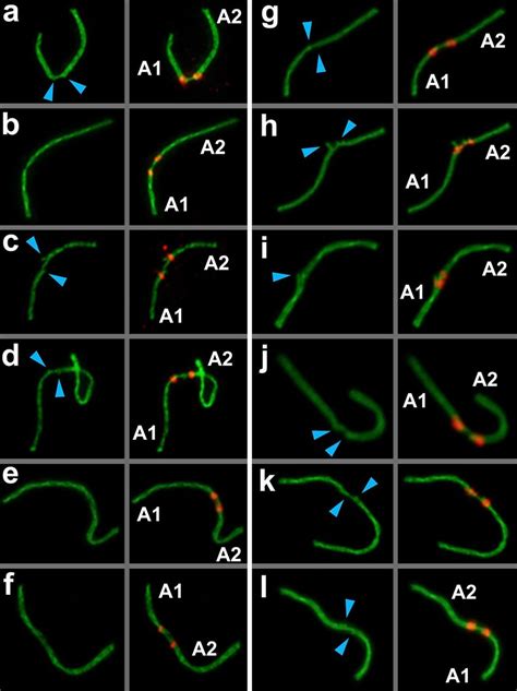 Anchoring Tethering And Fusion Of Non Homologous Acrocentric Download Scientific Diagram