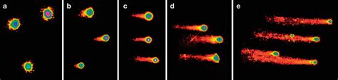 Single Cell Alkaline Comet Assay Gel Electrophoresis Of Fresh And