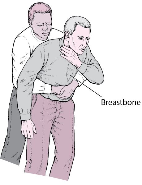 Choking Injuries And Poisoning Msd Manual Consumer Version