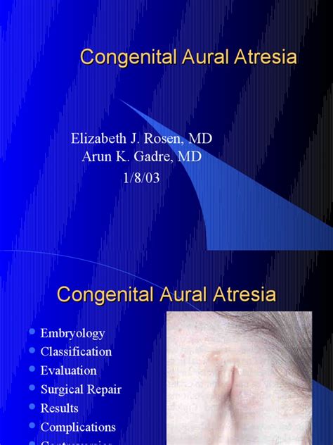 Congenital Aural Atresia | PDF | Ear | Hearing