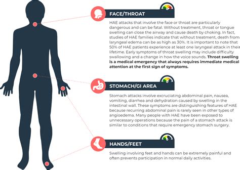 Us Hereditary Angioedema Association