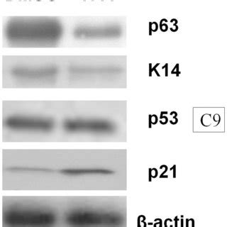 A H Cells Were Transfected With Pcdna Wild Type P Mutant