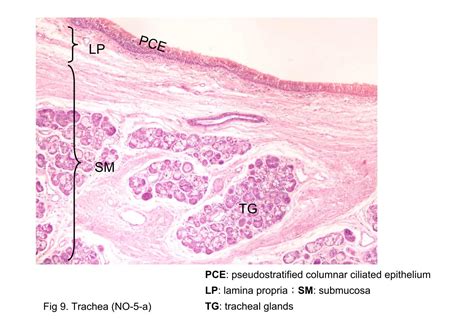 Block4fig 8 And 9 Trachea No 5 A