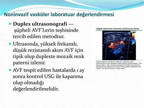 Ppt Giri Imsel Av Fist L Tan Ve Tedavisi Powerpoint Presentation