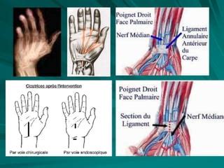 GAY POUTEAU COLLESghhhhhhhhhhhhhhh Ppt