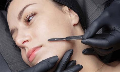 What Is Dermaplaning And Is It Good For All Skin