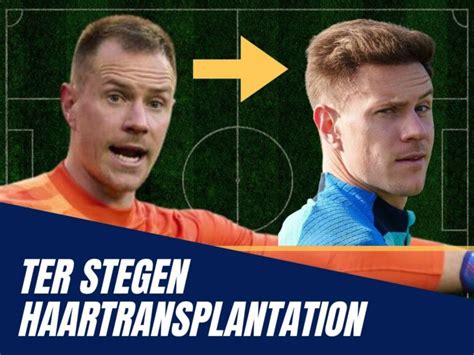 Ter Stegen Haartransplantation Haarausfall Und Technische Analyse