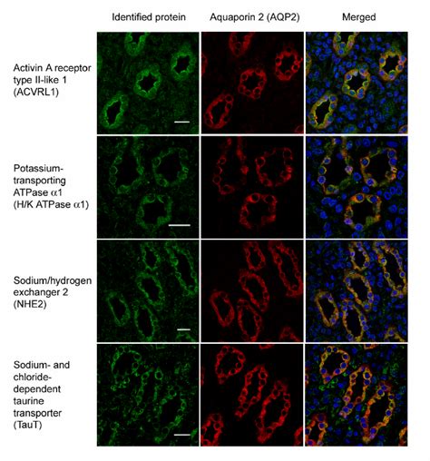 Confocal Immunofluorescence Microscopy Confirming The Expression Of Download Scientific Diagram