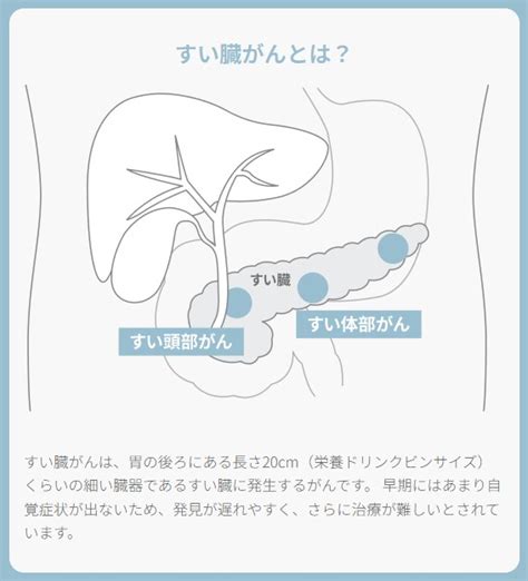 エランオンラインショップ 【送料無料】すい臓がんリスク腫瘍マーカー検査キット