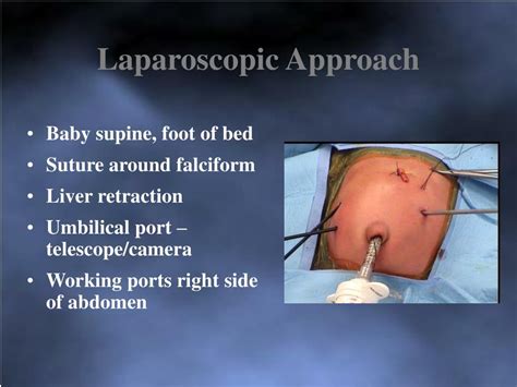 Ppt Laparoscopic Management Of Small Intestinal Atresia Powerpoint