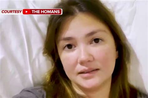 Angelica Panganiban Nagpapagaling Matapos Tamaan Ng Bone Disease Abs