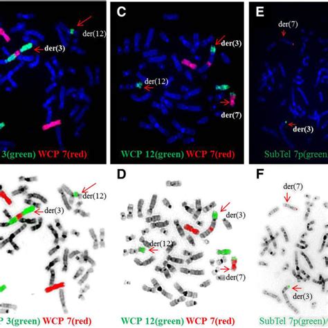 (PDF) Characterization of a complex chromosomal rearrangement using ...