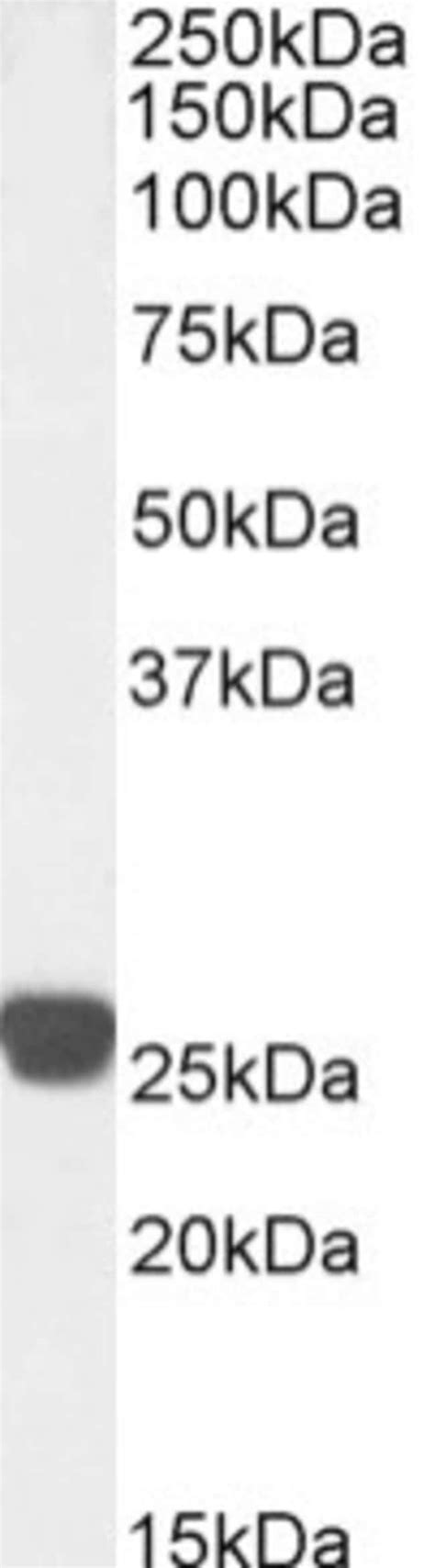 Cardiac Troponin I Chimeric Recombinant Mouse Monoclonal Antibody Scfv