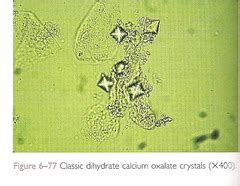 Urinalysis Lecture 6 Microscopic Examination Of Urine LMU Flashcards