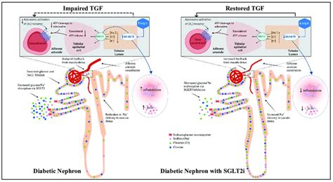 Proposed Renoprotective Mechanism Of Sodium Glucose Co Transporter