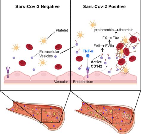 Circulating Extracellular Vesicles Are Endowed With Enhanced