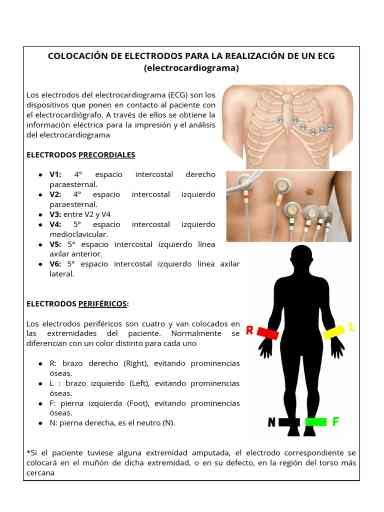 Guía Práctica Colocación De Electrodos En Un Electrocardiograma Neurat