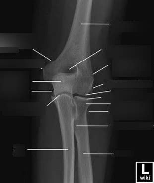 AP Left Elbow Diagram Quizlet