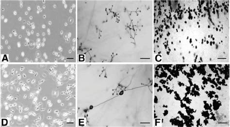 Morphological Characteristics Of A To C Verticillium Dahliae And D To