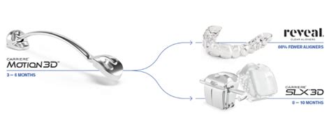 Carriere® Motion 3d™ Appliances Henry Schein® Orthodontics™