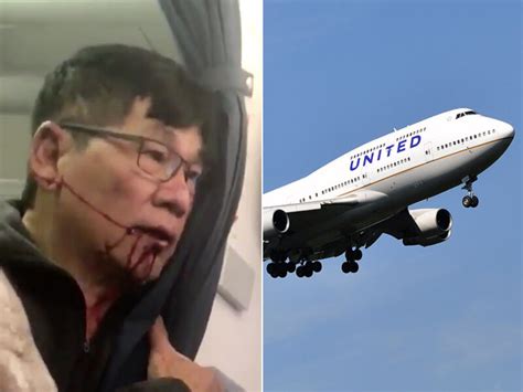 United Airlines And Dr David Dao Reach Amicable Settlement Thrillist