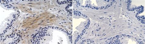 Monoclonal Anti Mad Mouse Antibody Sigma Aldrich