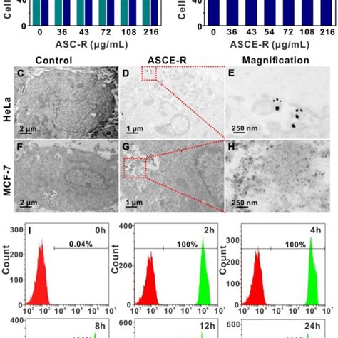 Ct Imaging A Of Asce R With Different Concentrations And The Hu Value Download Scientific