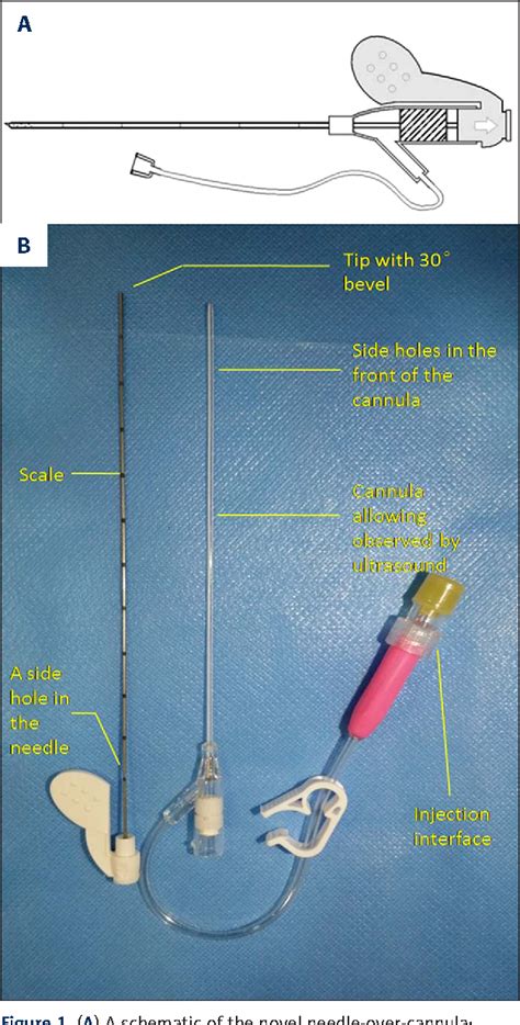 Figure 1 From Effects Of Postoperative Continuous Femoral Nerve Block