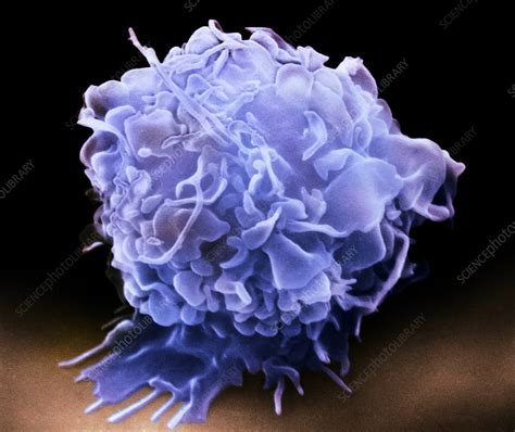 Macrophage Sem Stock Image P2760249 Science Photo Library