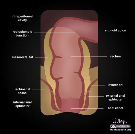 Rectum Illustrations Image Radiopaedia Org