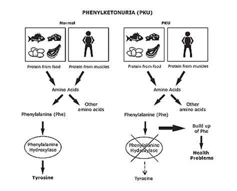 PKU - The ZB Foundation