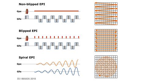 Mri Sequences Echo Planar Imaging Epi E Mri