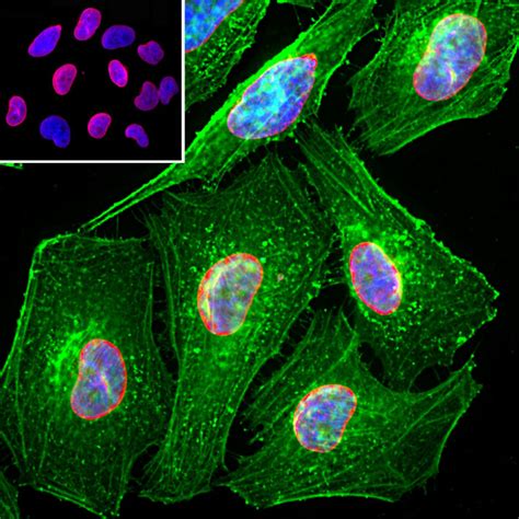 Chicken Polyclonal Antibody To GFAP Cat CPCA GFAP EnCor Biotechnology