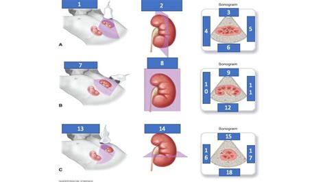 Transducer Orientations Chapter 1 Diagram Quizlet