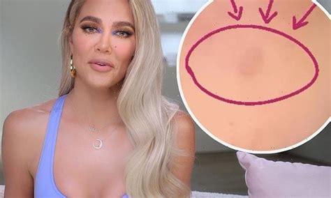 Khloe Kardashian Reveals She Had A TUMOR Removed From Her Face I Know