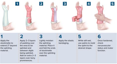 Procedures Splinting Walker Flashcards Quizlet