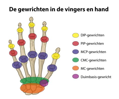 De PIP Gewrichten Van De Vingers Zijn Rood Omcirkeld De Duim Heeft