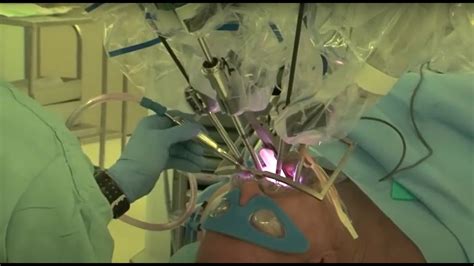 Artificial Intelligence AI Helps Humankind Surgery With Robots YouTube