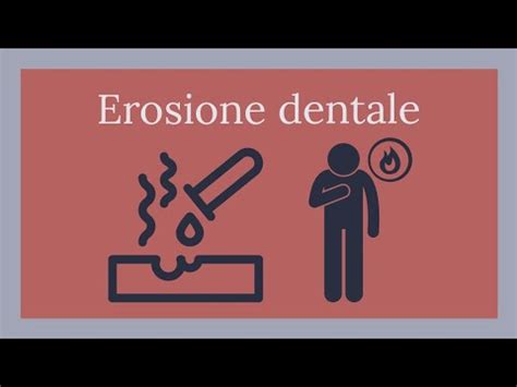 L Erosione Dentale Quali Sono Le Cause E Come Trattarla Youtube