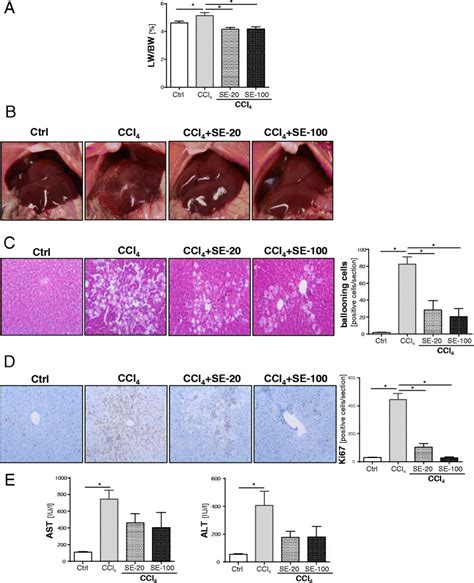 Effect Of Silymarin Se On Hepatocellular Damage In Ccl 4 Induced