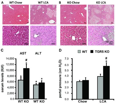 LCA Feeding Induces A More Pronounced Liver Injury In TGR5 Knockout