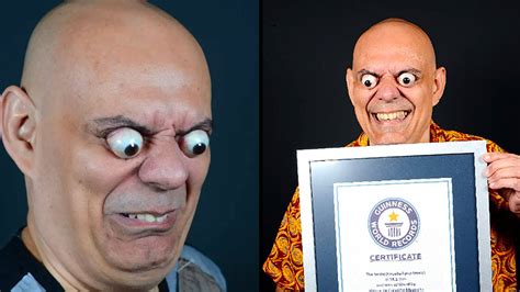 Man Sets New Guinness World Record For World S Largest Eyeball Pop