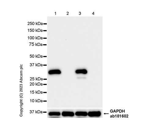 Recombinant Anti Cardiac Troponin I Antibody RM1073 Ab314912 Abcam