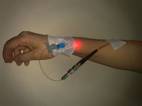 lazer_3 - Opr.Dr.Cafer Abbasoğlu