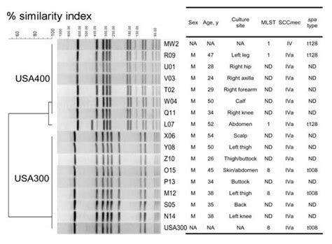 Pulsed Field Gel Electrophoresis Pfge Based Dendrogram Of