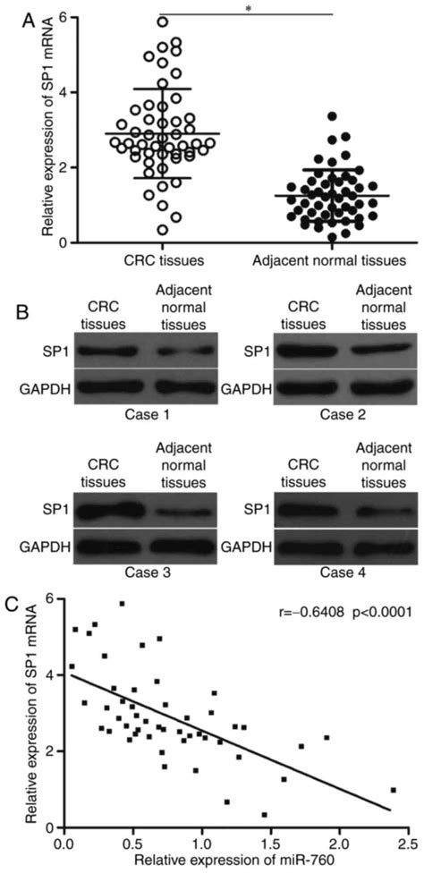 Microrna Inhibits Cell Proliferation And Invasion Of Colorectal